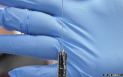 Phát hiện sớm ung thư bằng bọt biển